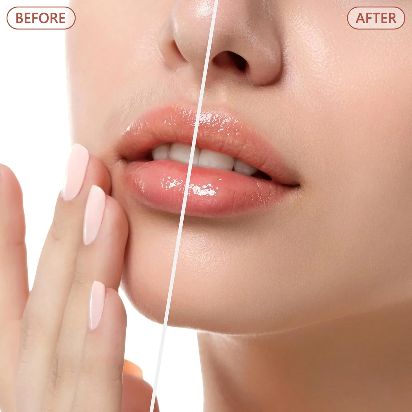 Hoeylife Facial Hair Remover for Women - Painless Face Shaver - Electric Hair Removal Device for Face Lips Peach Fuzz with Light (Rose Red)